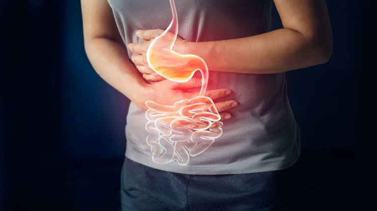 A gastrite é uma irritação do tubo digestivo, geralmente com inflamação